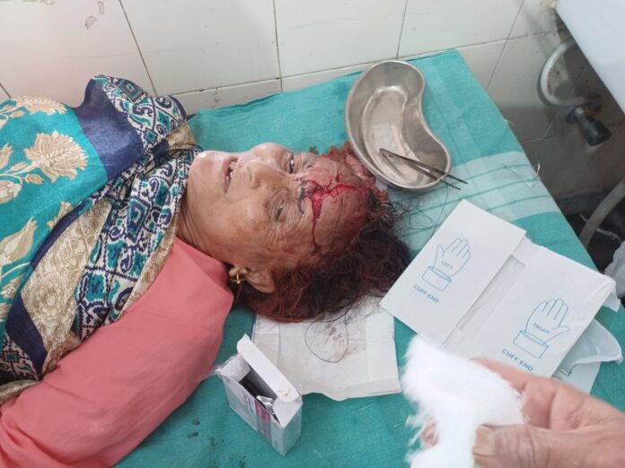 सिंगोली गांव में गुलदार के हमले से महिला हुई जख्मी - RAIBAR PAHAD KA